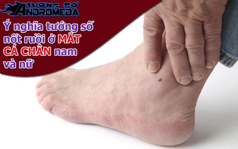 Xem nốt ruồi: Người có nốt ruồi ở MẮT CÁ CHÂN nam nữ
