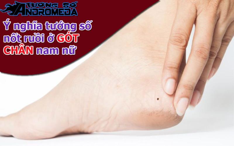 Xem nốt ruồi: Vận mệnh nam nữ có nốt ruồi ở GÓT CHÂN